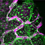 Immunofluorescent image of stage 57 X. laevis transgenic tadpole progenitor cells in the tectum labeled with DSHB antibody 14h7 against vimentin (green). PMID: 28795134, Fig. 1E.